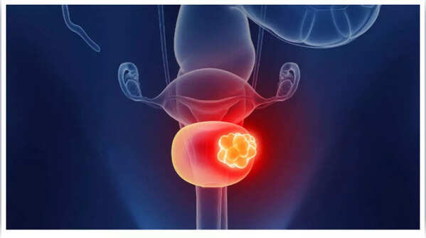 Lower back pain as a symptom