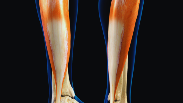 Diagram showing the location of the soleus muscle in the leg
