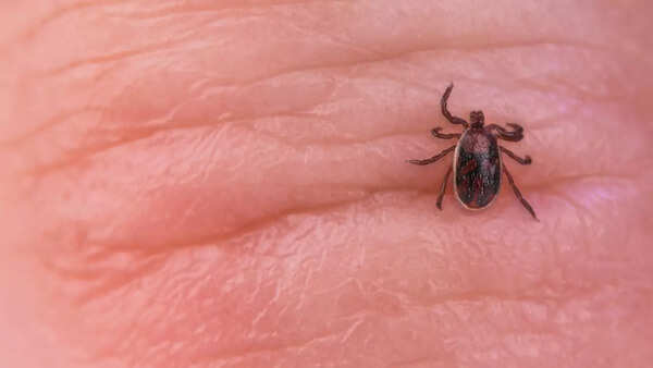 Fitness inspiration's health takes a turn after tick bite