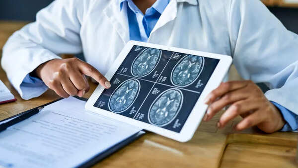 Conceptual image of a human brain.
